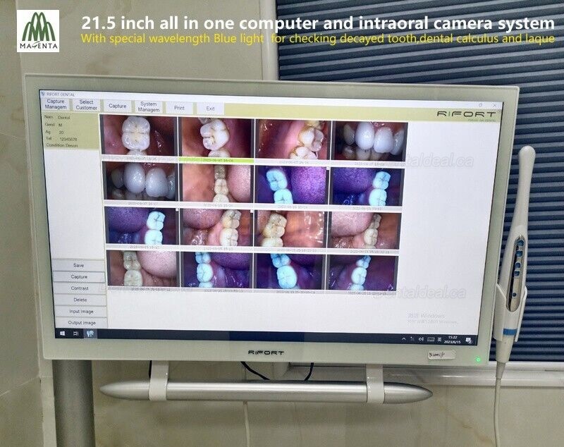 Magenta YF-2200P+ 21.5 Inch Touch Screen Intraoral Camera VGA+HDMI